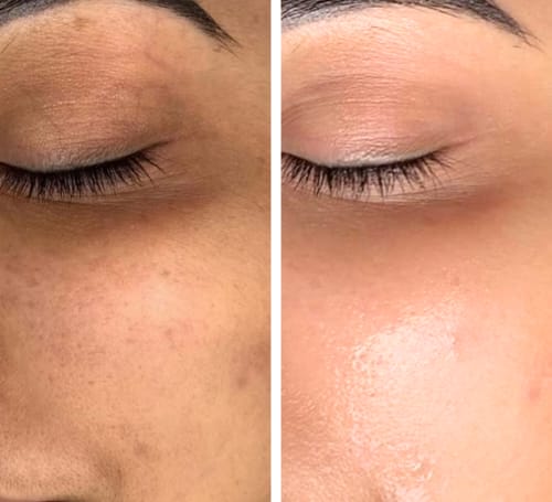 Dark Spots